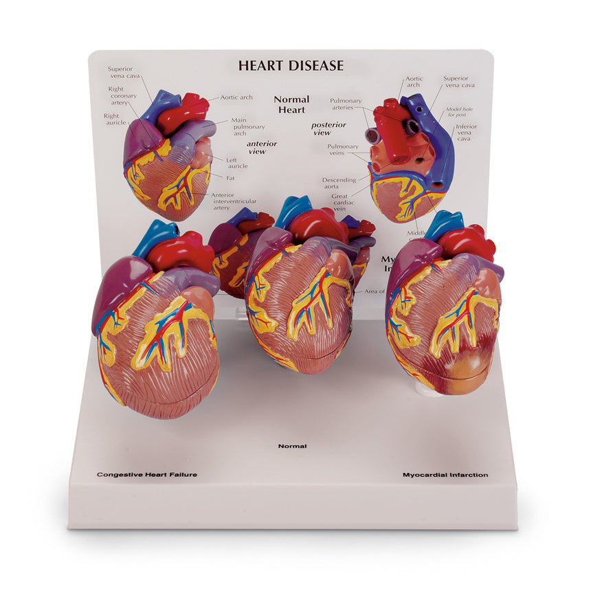 3-Piece Mini Heart Set Models