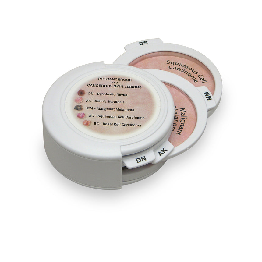  Nasco Healthcare-5-Piece Hinged Skin Cancer Disk Set-MedTech-1