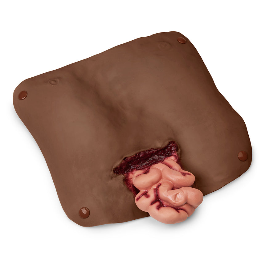  Nasco Healthcare-Abdominal Wound, Dark-MedTech-1