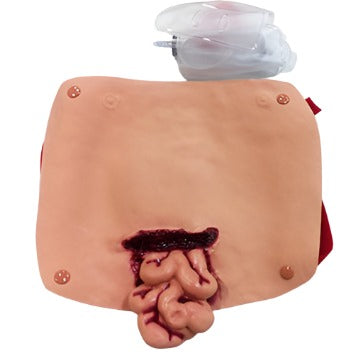 Abdominal Wound With Protruding Intestines