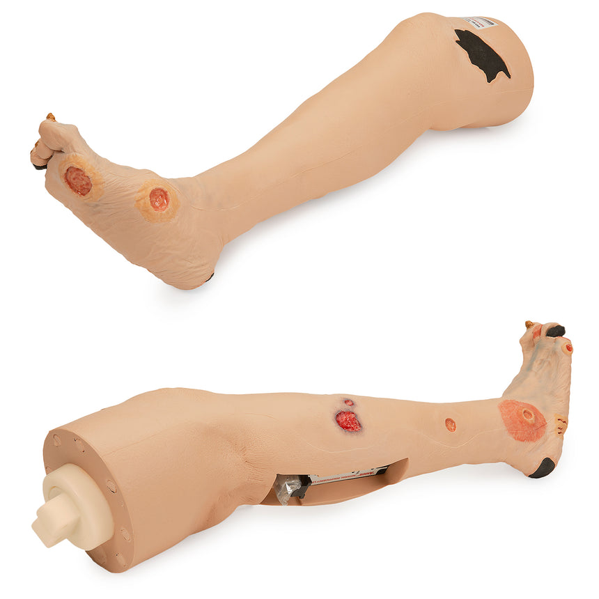  Nasco Healthcare-Annie Arterial Insufficiency Leg-MedTech-1