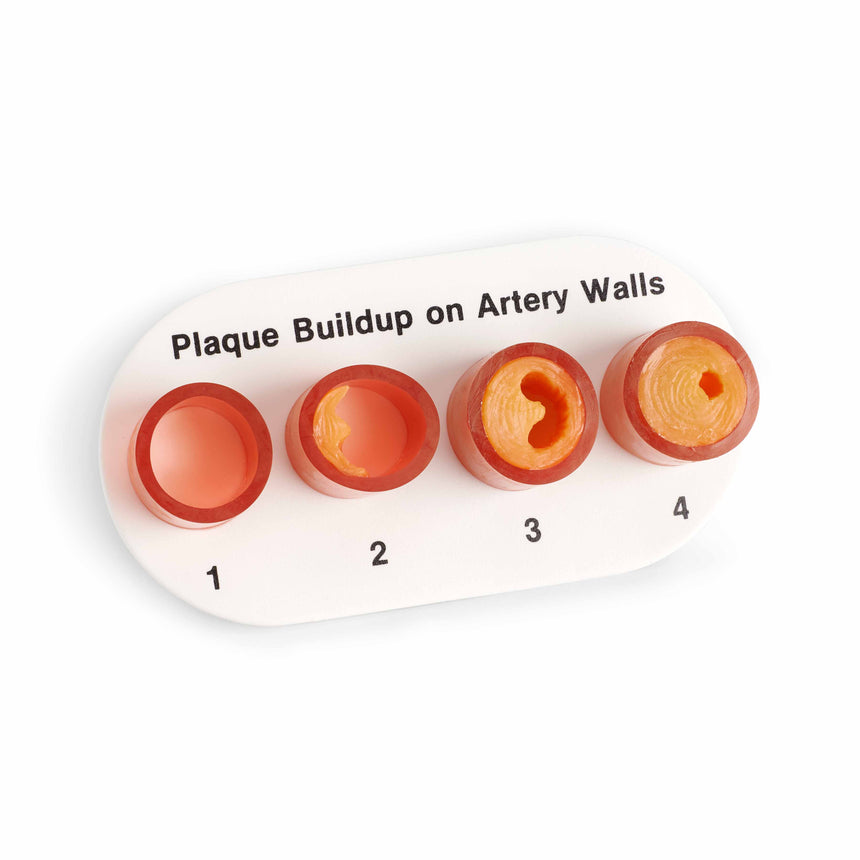  Nasco Healthcare-Artery Sections with Blockage-MedTech-1