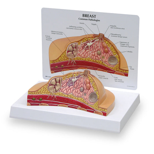  Nasco Healthcare-Breast Cross-Section Model-MedTech-1