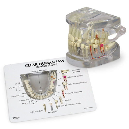  Nasco Healthcare-Clear Human Jaw with Teeth-MedTech-1