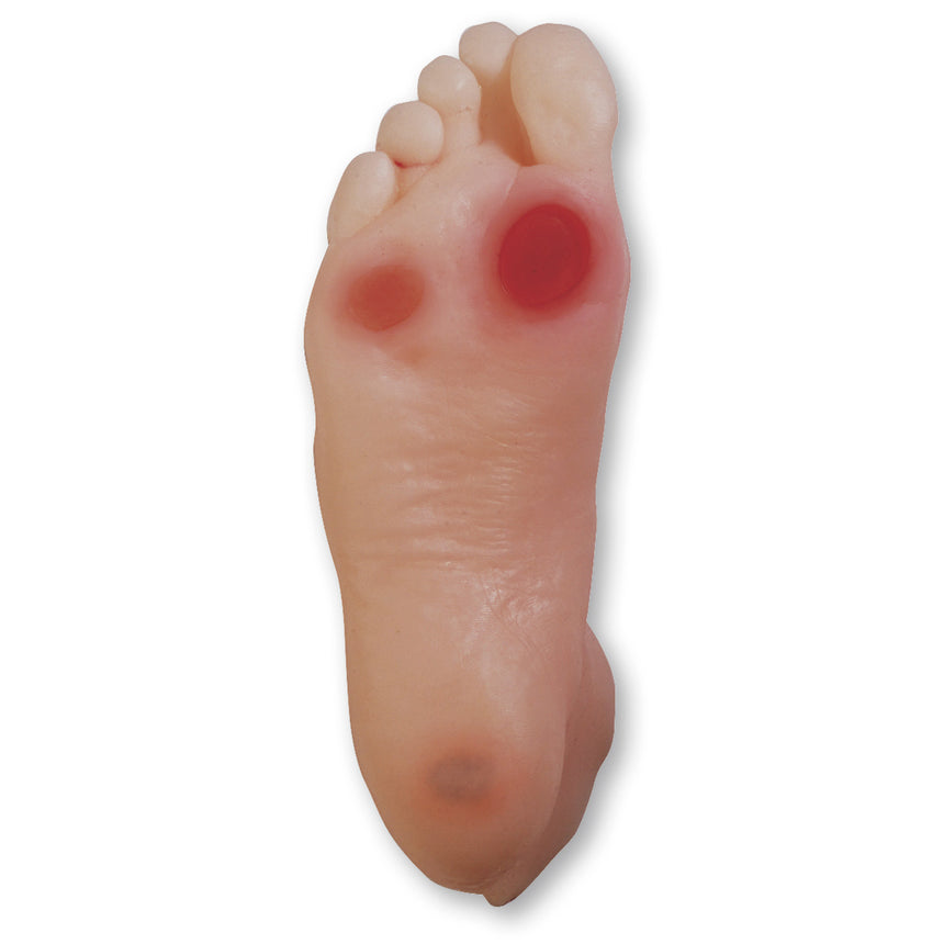  Nasco Healthcare-Diabetic Foot Model-MedTech-1