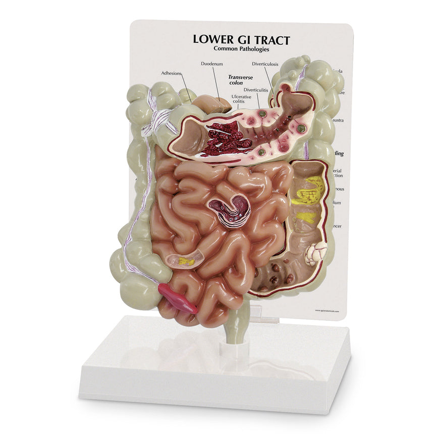  Nasco Healthcare-GI Tract-MedTech-1