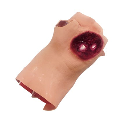  Nasco Healthcare-Gunshot Wound Palm-MedTech-1