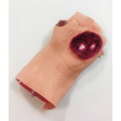 Gunshot Wound Palm