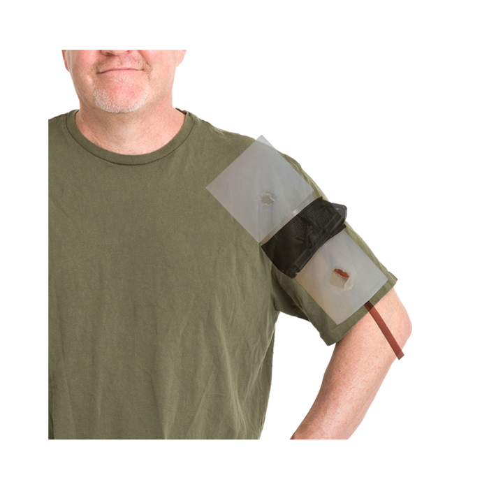 Phokus Research Group- Wound CLUB™ PRO Gen2-Medtech- 6