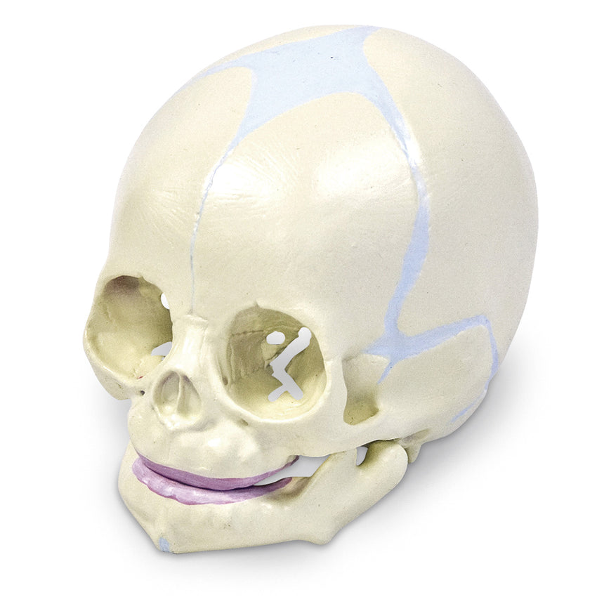  Nasco Healthcare-Human Fetal Skull-MedTech-1