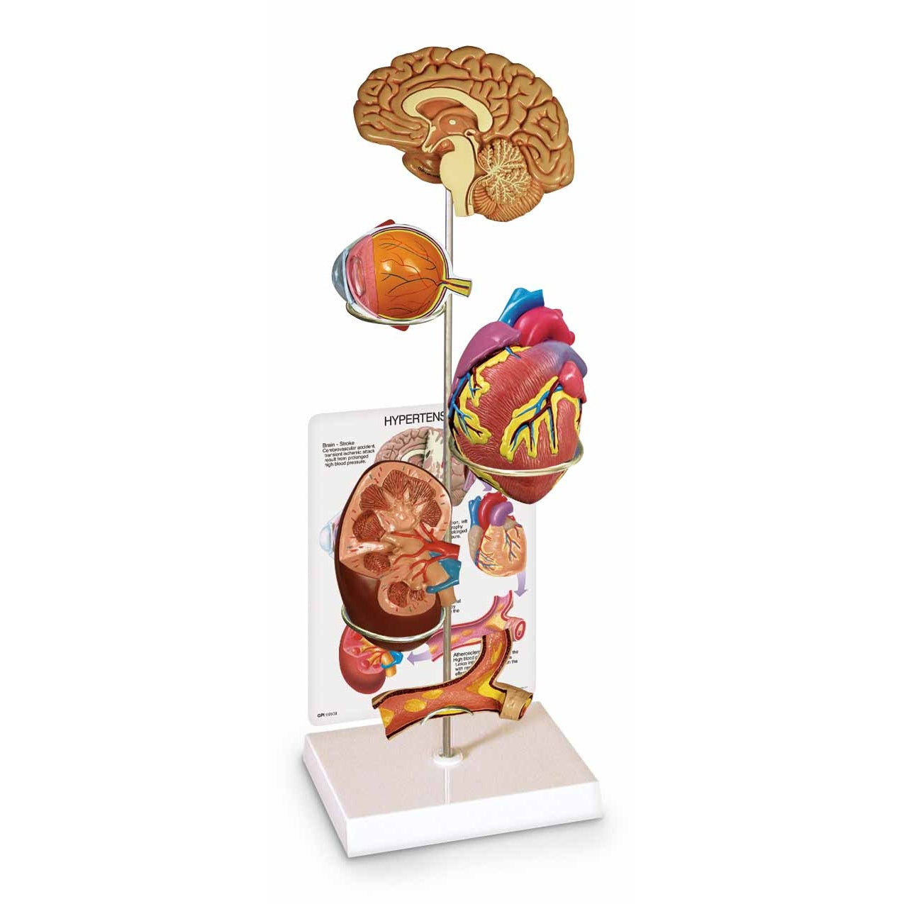  Nasco Healthcare-Hypertension Model Set-MedTech-1