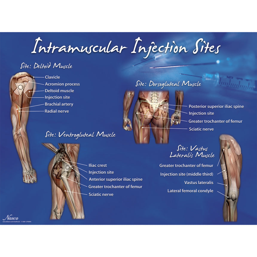 Intramuscular Injection Sites Display