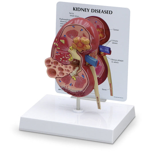 Kidney Model with Pathologies