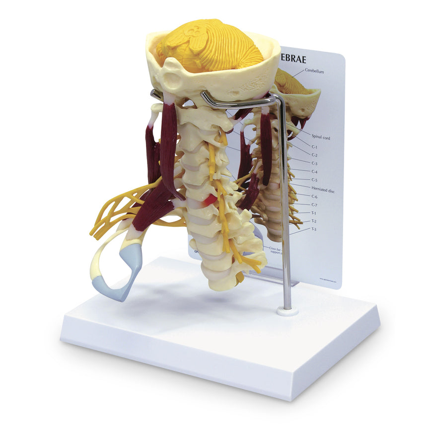  Nasco Healthcare-Life-Size Cervical Model with Muscles and Nerves-MedTech-1