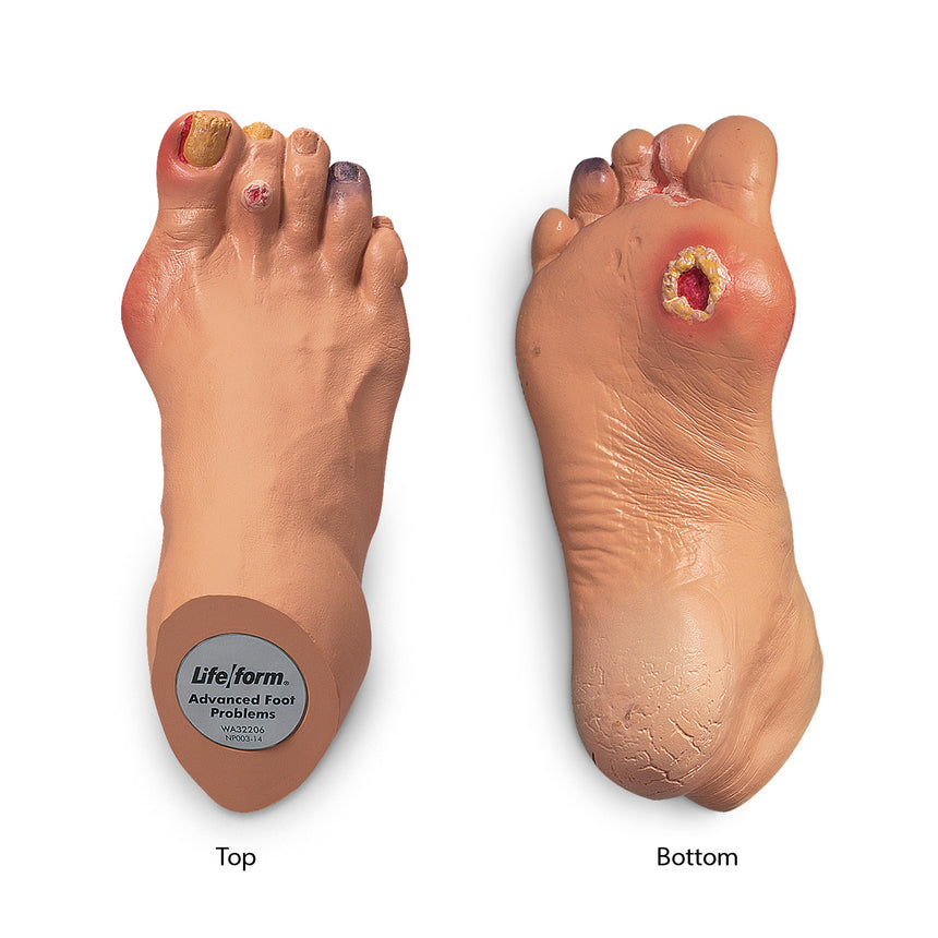 Life/form® Advanced Foot Problems