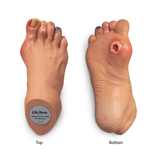 Life/form® Advanced Foot Problems