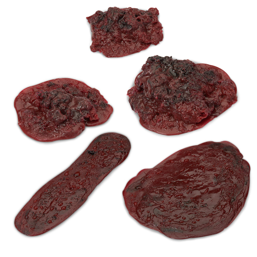 Life/form® Clots and Hemorrhages - Set of 5