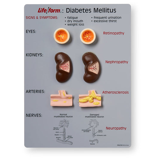 Life/form® Diabetes Mellitus Teaching Kit