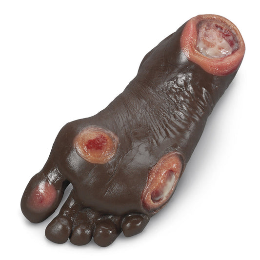 Life/form® Elderly Pressure Ulcer Foot