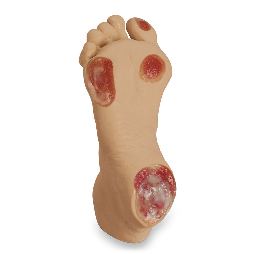 Life/form® Elderly Pressure Ulcer Foot