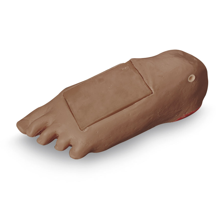 Life/form® GERi / KERi Optional Edema Foot with Deep Tissue Injury - Medium