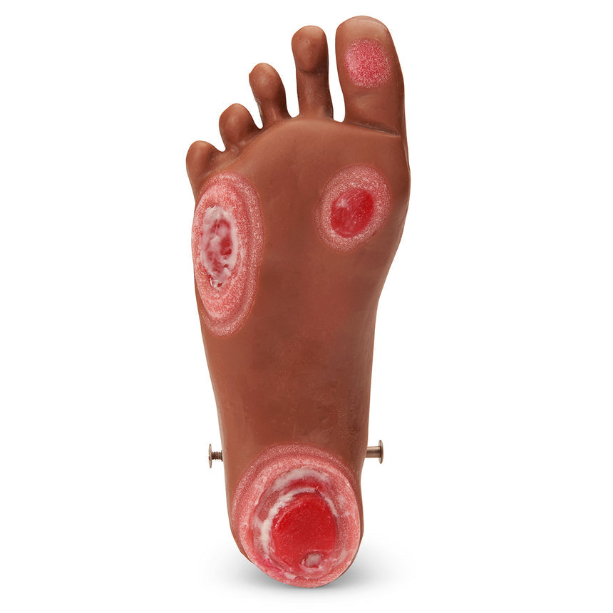 Life/form® GERi / KERi Optional Pressure Injury Foot - Medium