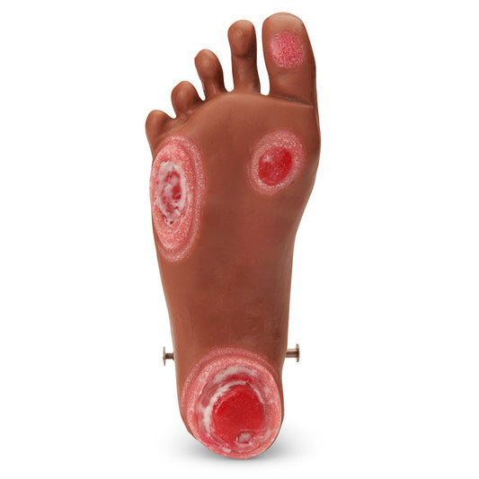 Life/form® GERi / KERi Optional Pressure Injury Foot - Medium