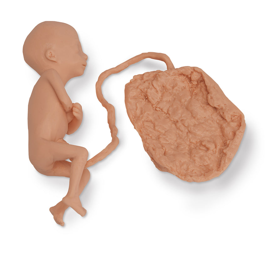 Life/form® Human Fetus Replica - 5 Month