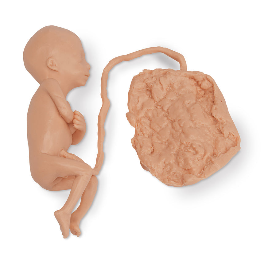 Life/form® Human Fetus Replica - 5 Month