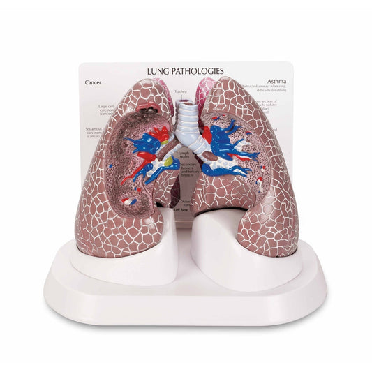 Lung Set with Pathologies