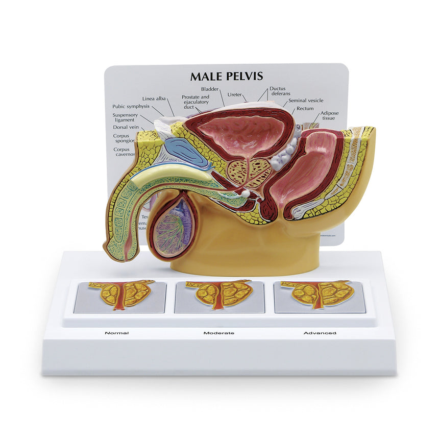 Male Pelvis with Prostate and BPH