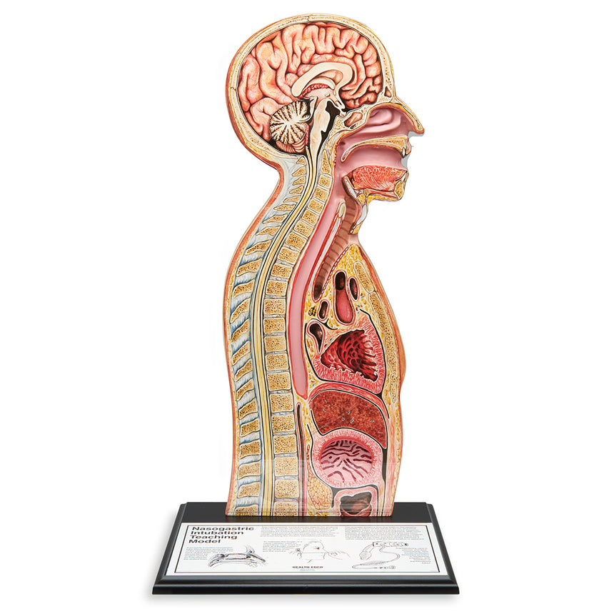 Nasogastric Tube Feeding Model