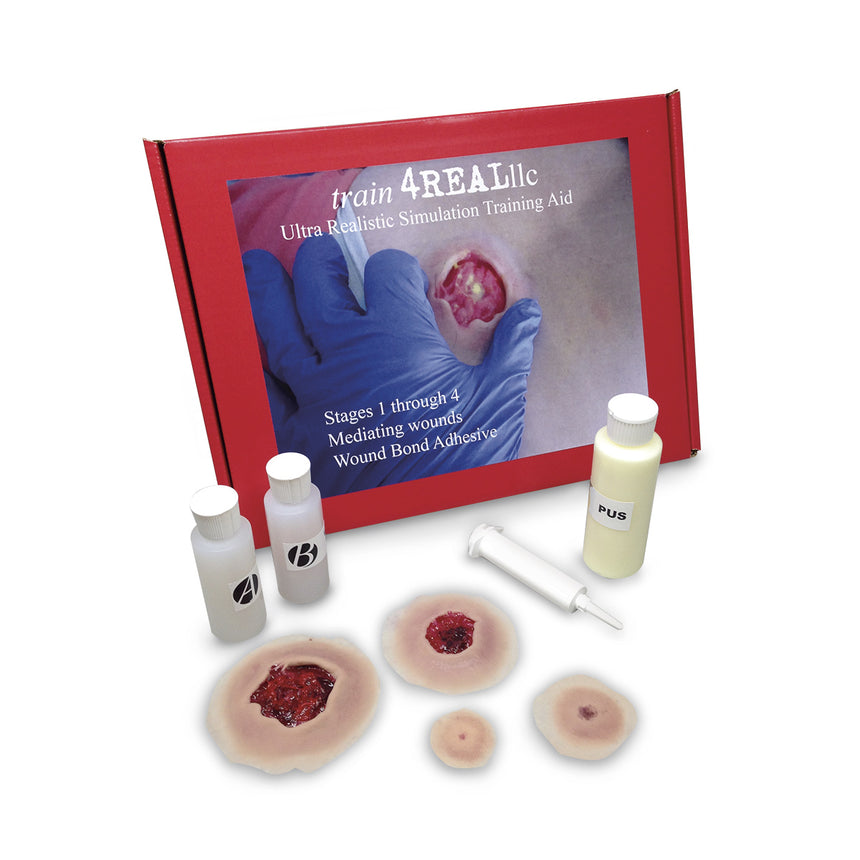 Pressure Ulcer Simulation Training Kit - Light