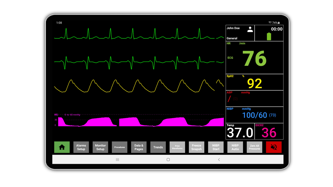 SimVS Critical Care Complete