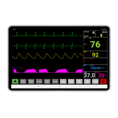 SimVS Critical Care Complete