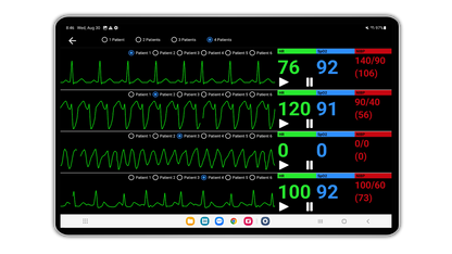 SimVS Critical Care Complete