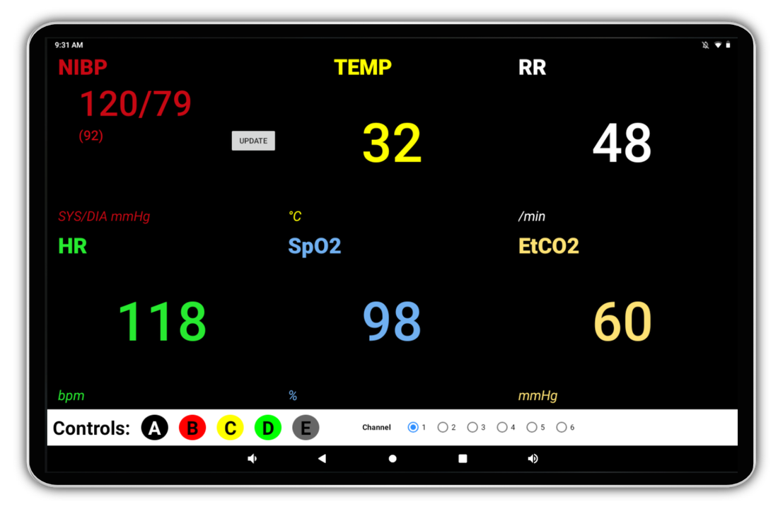 SimVS Diagnostic Essentials