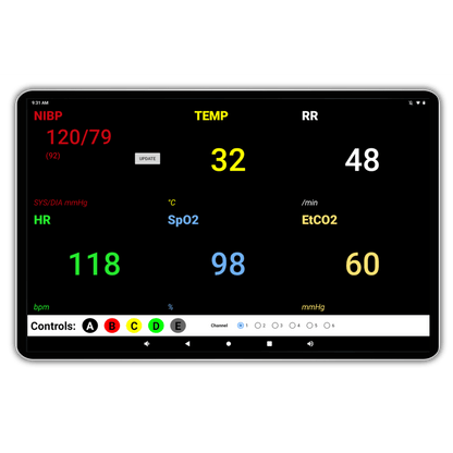 SimVS Diagnostic Essentials