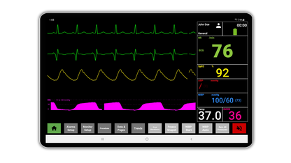 SimVS EMS