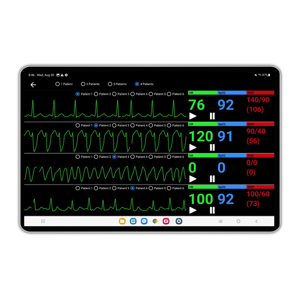 SimVS EMS