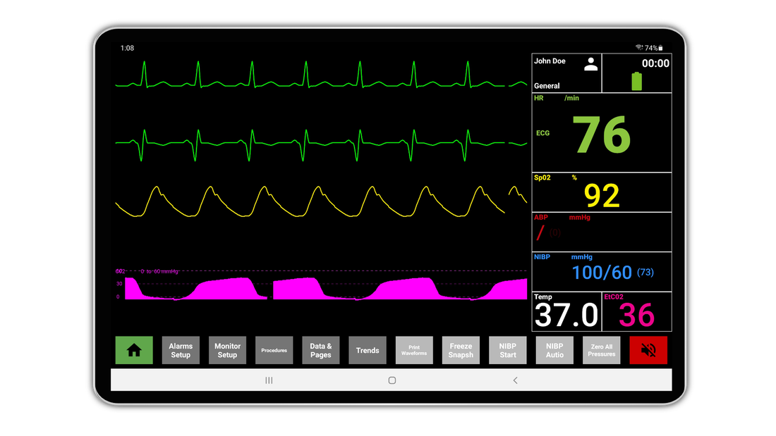 SimVS Nucleus Plus with IV