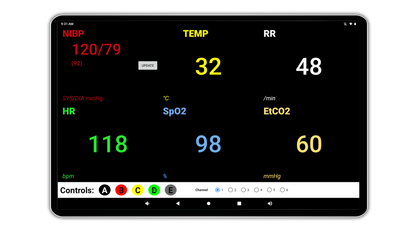 SimVS Nucleus Plus with IV