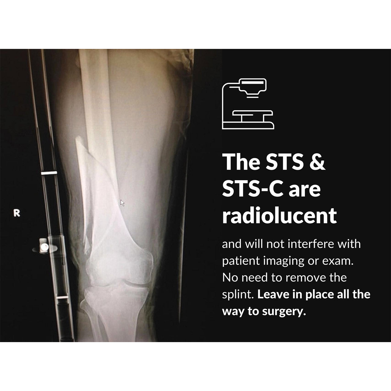 Slishman Traction Splint Compact STS-C