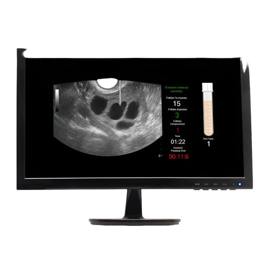 SonoHysteroSim LCD Monitor