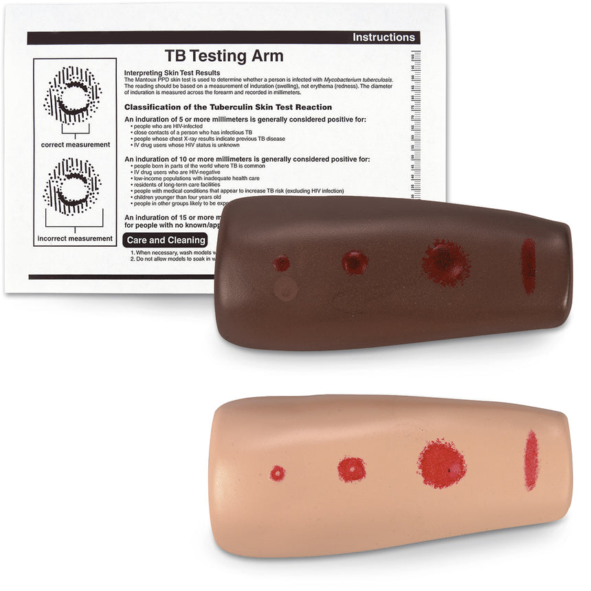 TB Testing Arm