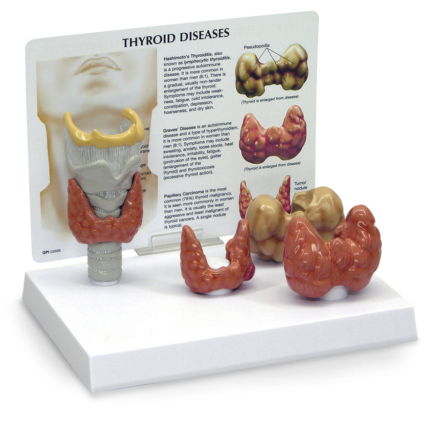 Thyroid Model