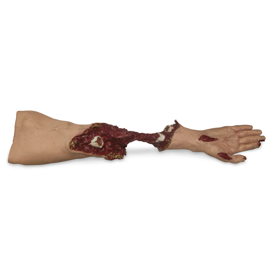 Xtreme Trauma Moulage Arm